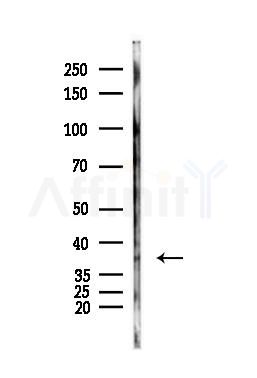 hnRNP A2/B1 Antibody - Western blot analysis of lysates from Hela cells(heat-shock,45min treatment), using hnRNP A2/B1 Antibody at 1/1000 dilution.