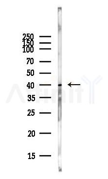 CXCR4 Antibody - Western blot analysis of lysates from COLO205 cells(heat-shock,45min treatment), using CXCR4 Antibody at 1/1000 dilution.