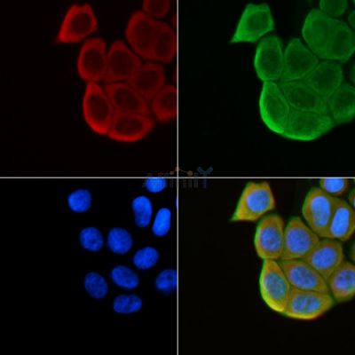 MEN1 Antibody - AF5285 staining Hela cells(30min of UV treatment) by IF/ICC.