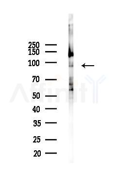 GRP94 Antibody - Western blot analysis of lysates from Hela cells(UV,30min treatment), using GRP94 Antibody at 1/1000 dilution.