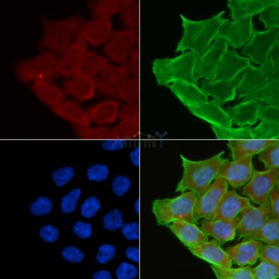 CMKLR1 Antibody - AF5291 staining Hela cells(30min of UV treatment) by IF/ICC.