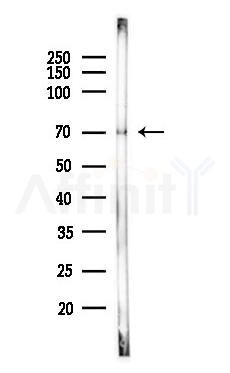 ADAM10 Antibody - Western blot analysis of lysates from Mouse testis, using ADAM10 Antibody at 1/1000 dilution.