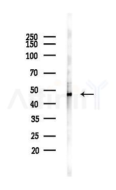 I-TRAF Antibody - Western blot analysis of lysates from Hela cells(UV,30min treatment), using I-TRAF Antibody at 1/1000 dilution.