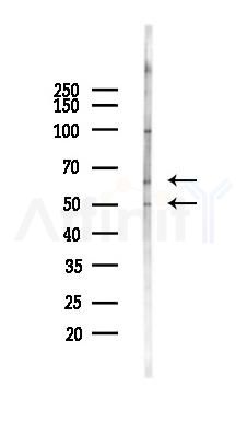 PPAR  alpha Antibody - Western blot analysis of lysates from Hela cells(UV,30min treatment), using PPAR  alpha Antibody at 1/1000 dilution.