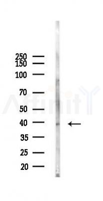 CLTR1 Antibody - Western blot analysis of lysates from Mouse testis, using CLTR1 Antibody at 1/1000 dilution.