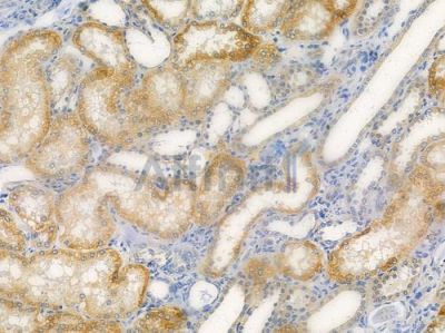CLTR1 Antibody - AF5308 at 1/100 staining human normal kidney tissue by IHC-P.