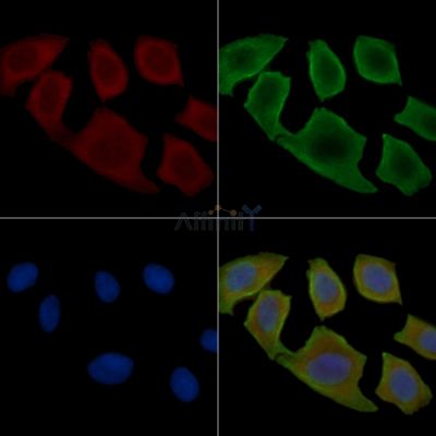 EDG2 Antibody - AF5322 staining Hela cells(30min of UV treatment) by IF/ICC.