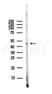 Aurora A Antibody - Western blot analysis of lysates from EC304 cells(LPS,4h treatment), using Aurora A Antibody at 1/1000 dilution.