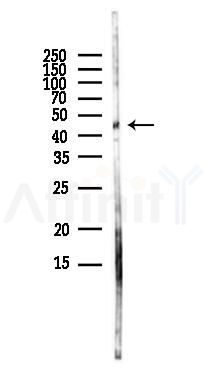 Aurora A Antibody - Western blot analysis of lysates from Rat brain, using Aurora A Antibody at 1/1000 dilution.
