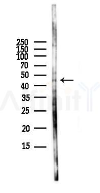 Aurora A Antibody - Western blot analysis of lysates from HUVEC cells(LPS,4h treatment), using Aurora A Antibody at 1/1000 dilution.