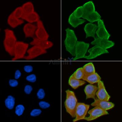 Integrin beta 5 Antibody - AF5327 staining Hela cells(30min of UV treatment) by IF/ICC.