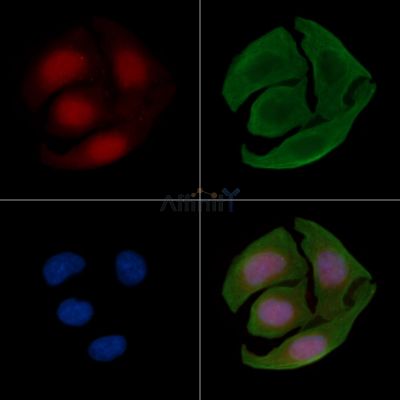 PIAS4 Antibody - AF5329 staining Hela cells(30min of UV treatment) by IF/ICC.