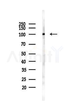 alpha 1 Catenin Antibody - Western blot analysis of lysates from Hela cells(UV,30min treatment), using alpha 1 Catenin Antibody at 1/1000 dilution.