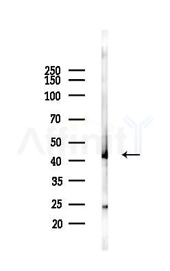 Connexin 43 / GJA1 Antibody - Western blot analysis of lysates from Hela cells(UV,30min treatment), using Connexin 43 / GJA1 Antibody at 1/1000 dilution.