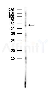 CD4 Antibody - Western blot analysis of lysates from Rat brain, using CD4 Antibody at 1/1000 dilution.