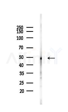 HDAC3 Antibody - Western blot analysis of lysates from Hela cells(UV,30min treatment), using HDAC3 Antibody at 1/1000 dilution.