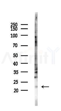Claudin 4 Antibody - Western blot analysis of lysates from Hela cells(UV,30min treatment), using Claudin 4 Antibody at 1/1000 dilution.