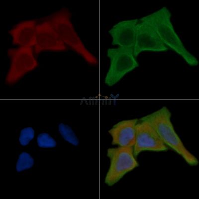 ACTG2 Antibody - AF5351 staining Hela cells(30min of UV treatment) by IF/ICC.