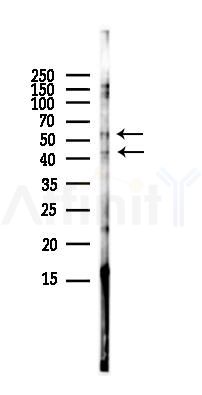 c-Fos Antibody - Western blot analysis of lysates from HUVEC cells(LPS,4h treatment), using c-Fos Antibody at 1/1000 dilution.