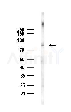 GRP78 Antibody - Western blot analysis of lysates from Hela cells(UV,30min treatment), using GRP78 Antibody at 1/1000 dilution.
