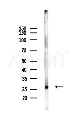 RAN Antibody - Western blot analysis of lysates from Hela cells(UV,30min treatment), using RAN Antibody at 1/1000 dilution.