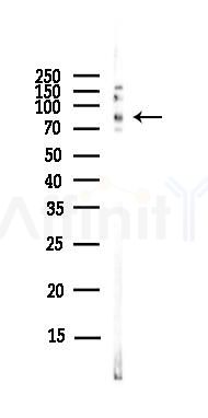 Hsp90 alpha Antibody - Western blot analysis of lysates from EC304 cells(LPS,4h treatment), using Hsp90 alpha Antibody at 1/1000 dilution.