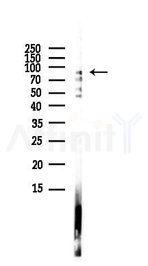 Hsp90 alpha Antibody - Western blot analysis of lysates from HUVEC cells(LPS,4h treatment), using Hsp90 alpha Antibody at 1/1000 dilution.