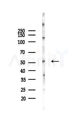 Cytokeratin 14 Antibody - Western blot analysis of lysates from Hela cells(UV,30min treatment), using Cytokeratin 14 Antibody at 1/1000 dilution.
