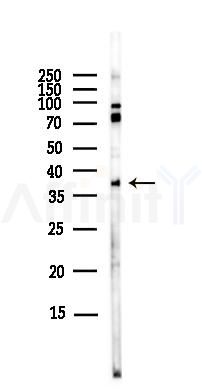 PAR4 Antibody - Western blot analysis of lysates from EC304 cells(LPS,4h treatment), using PAR4 Antibody at 1/1000 dilution.