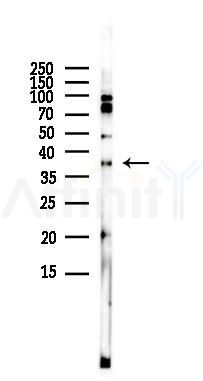 PAR4 Antibody - Western blot analysis of lysates from HUVEC cells(LPS,4h treatment), using PAR4 Antibody at 1/1000 dilution.