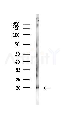 Caveolin 1 Antibody - Western blot analysis of lysates from Hela cells(UV,30min treatment), using Caveolin 1 Antibody at 1/1000 dilution.