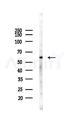 HSP60 Antibody - Western blot analysis of lysates from Mouse testis, using HSP60 Antibody at 1/1000 dilution.