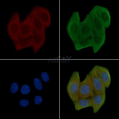 Cleaved-Caspase 6 (Asp179) Antibody - AF5381 staining Hela cells(30min of UV treatment) by IF/ICC.