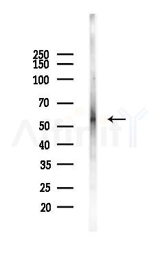 Glut 4 Antibody - Western blot analysis of lysates from Hela cells(UV,30min treatment), using Glut 4 Antibody at 1/1000 dilution.