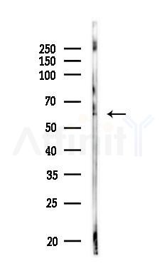 HNF1 beta Antibody - Western blot analysis of lysates from MDA-MB-231 cells, using HNF1 beta Antibody at 1/1000 dilution.