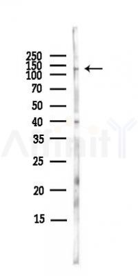 PGC1 Antibody - Western blot analysis of lysates from EC304 cells(LPS,4h treatment), using PGC1 alpha Antibody at 1/1000 dilution.