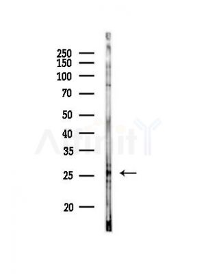 Calsenilin/KCNIP3 Antibody - Western blot analysis of lysates from HepG2 cells(starvation,24h treatment), using Calsenilin/KCNIP3 Antibody at 1/1000 dilution.