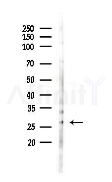 Caveolin 2 Antibody - Western blot analysis of lysates from Mouse lung, using Caveolin 2 Antibody at 1/1000 dilution.