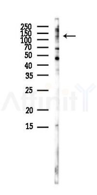 TERT Antibody - Western blot analysis of lysates from Rat brain, using TERT Antibody at 1/1000 dilution.