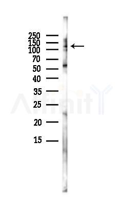 TERT Antibody - Western blot analysis of lysates from HUVEC cells(LPS,4h treatment), using TERT Antibody at 1/1000 dilution.