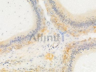 MRLC1 Antibody - AF5423 at 1/100 staining human testicular cancer by IHC-P.