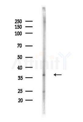 Phospho-Cyclin H (Thr315) Antibody - Western blot analysis of lysates from LoVo cells(heat-shock,45min treatment), using Phospho-Cyclin H (Thr315) Antibody at 1/1000 dilution.