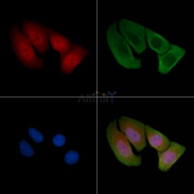 Phospho-Cyclin D2 (Thr280) Antibody - AF5430 staining Hela cells(30min of UV treatment) by IF/ICC.