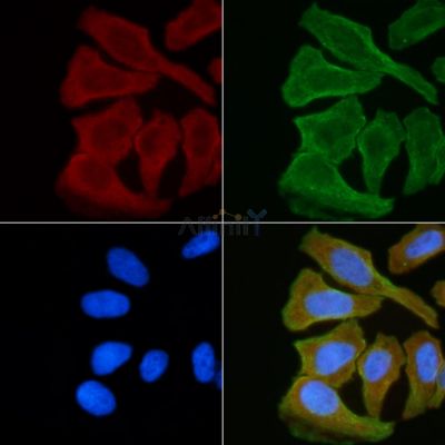Phospho-Lck (Ser59) Antibody - AF5432 staining Hela cells(30min of UV treatment) by IF/ICC.