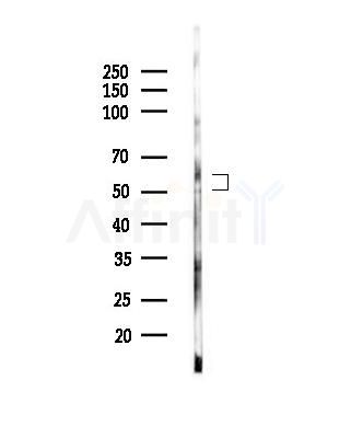 Phospho-hnRNP K (Ser284) Antibody - Western blot analysis of lysates from MCF7 cells(heat-shock,45min treatment), using Phospho-hnRNP K (Ser284) Antibody at 1/1000 dilution.