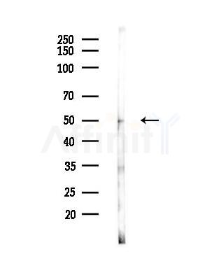 Phospho-hnRNP K (Ser284) Antibody - Western blot analysis of lysates from EC304 cells(heat-shock,45min treatment), using Phospho-hnRNP K (Ser284) Antibody at 1/1000 dilution.