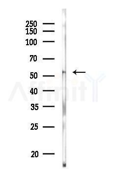 PTEN Antibody - Western blot analysis of lysates from PC12 cells, using PTEN Antibody at 1/1000 dilution.