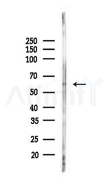 TGFBR2 Antibody - Western blot analysis of lysates from Mouse lung, using TGFBR2 Antibody at 1/1000 dilution.
