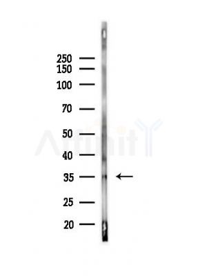 PKA alpha  CAT Antibody - Western blot analysis of lysates from Mouse liver, using PKA alpha  CAT Antibody at 1/1000 dilution.