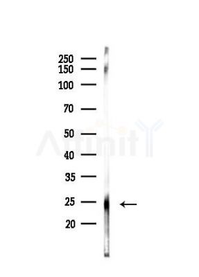 PPP1R2 Antibody - Western blot analysis of lysates from Mouse liver, using PPP1R2 Antibody at 1/1000 dilution.